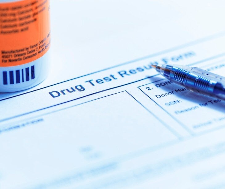 Image of drug test paperwork for blog about When can drug test results be shared without consent?