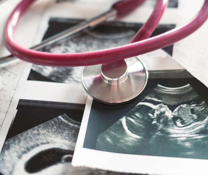 Image of stethoscope over image of ultrasound. 