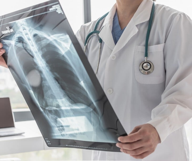 Image of a doctor holding an X-ray.