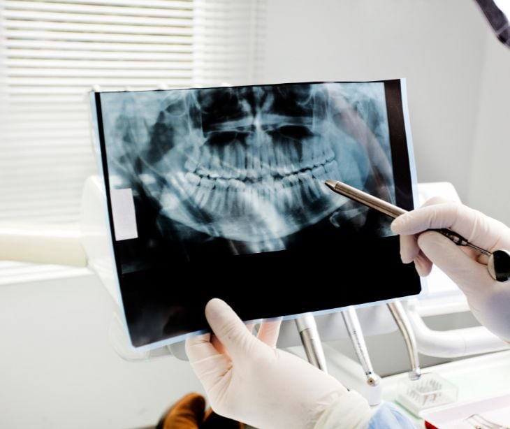 Absolute Dental breach exposes data of over 1.2 million patients